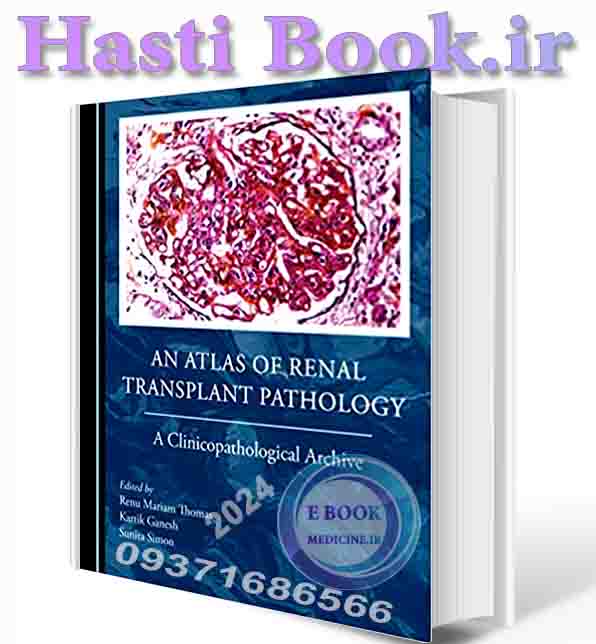 دانلود کتاب An Atlas of Renal Transplant Pathology: A Clinicopathological Archive 1st Edition 2023  (ORIGINAL PDF)